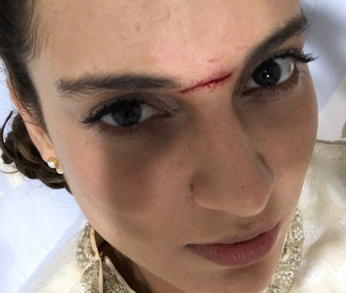 Kangana Ranaut hospitalized after getting injured on the sets of Manikarnika The Queen of Jhansi