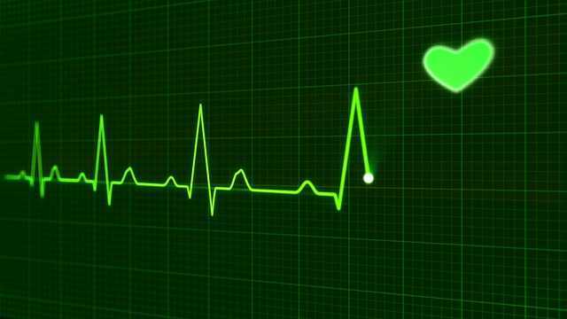 Kidney disease can cause irregular heart beat rate – Study