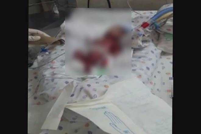 Max Hospital: Officials wrongly declare a new born baby dead